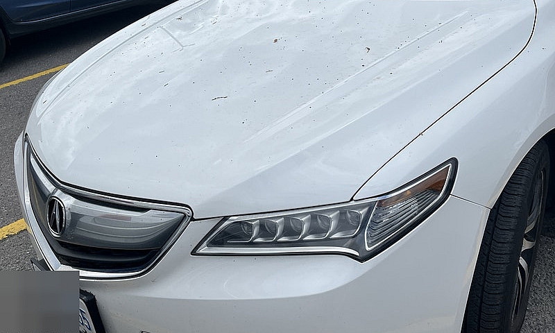 2016 Acura Tlx Techn...