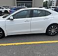 2016 Acura Tlx Technology Package – 2.4L – 140,000 Km